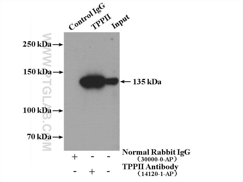 Immunoprecipitation (IP) experiment of Jurkat cells using TPPII Polyclonal antibody (14120-1-AP)