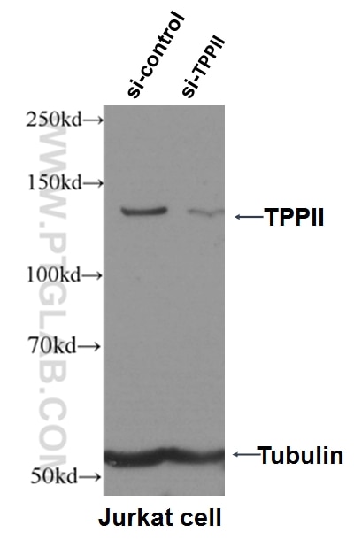 Western Blot (WB) analysis of Jurkat cells using TPPII Polyclonal antibody (14120-1-AP)