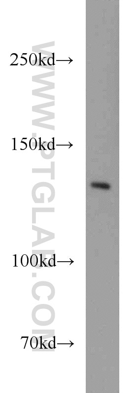 Western Blot (WB) analysis of Jurkat cells using TPPII Polyclonal antibody (14120-1-AP)
