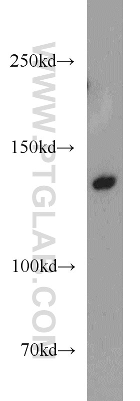 Western Blot (WB) analysis of K-562 cells using TPPII Polyclonal antibody (14120-1-AP)