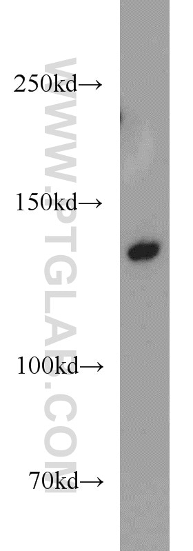 WB analysis of K-562 using 14120-1-AP