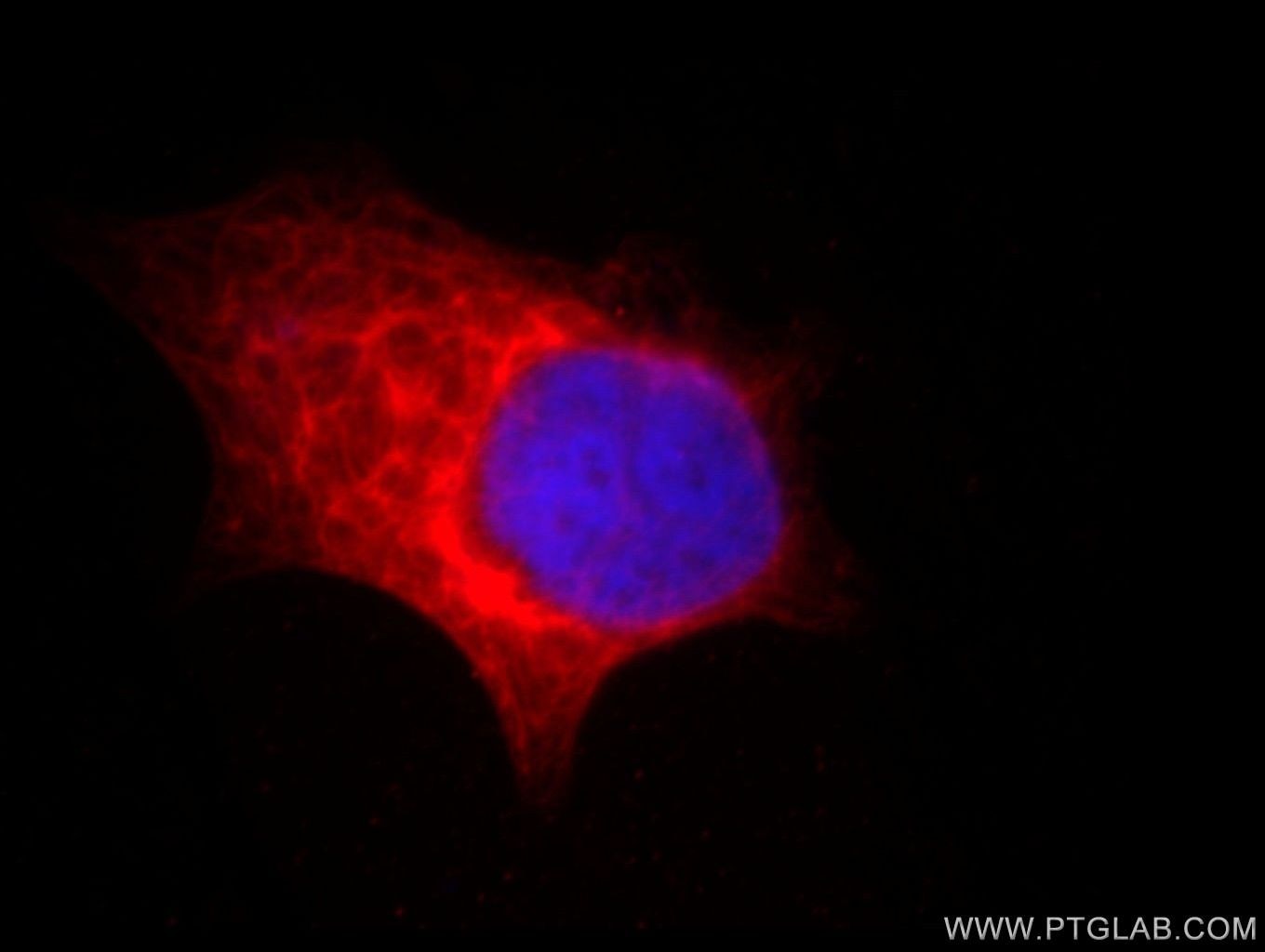 Immunofluorescence (IF) / fluorescent staining of HeLa cells using TPPII Monoclonal antibody (66017-1-Ig)