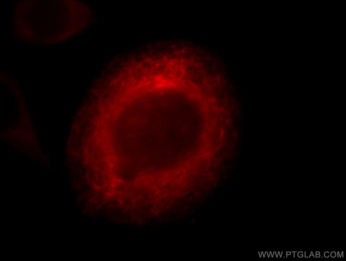 Immunofluorescence (IF) / fluorescent staining of MCF-7 cells using TPPII Monoclonal antibody (66017-1-Ig)