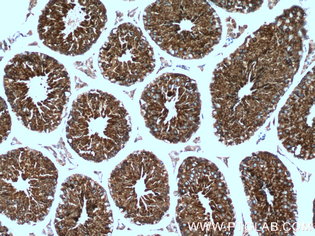 Immunohistochemistry (IHC) staining of mouse testis tissue using TPPII Monoclonal antibody (66017-1-Ig)