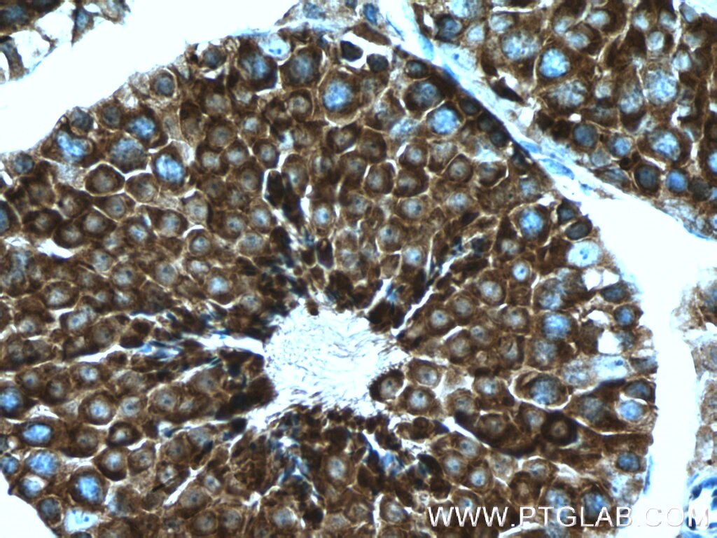 Immunohistochemistry (IHC) staining of mouse testis tissue using TPPII Monoclonal antibody (66017-1-Ig)