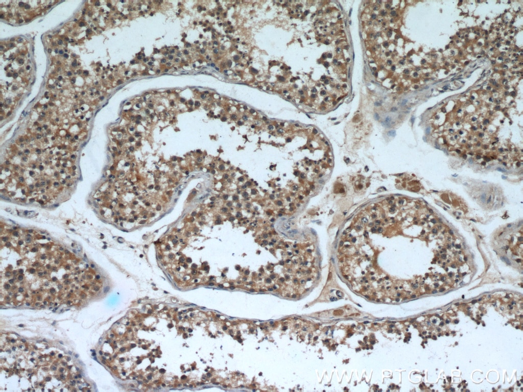 IHC staining of human testis using 66017-1-Ig