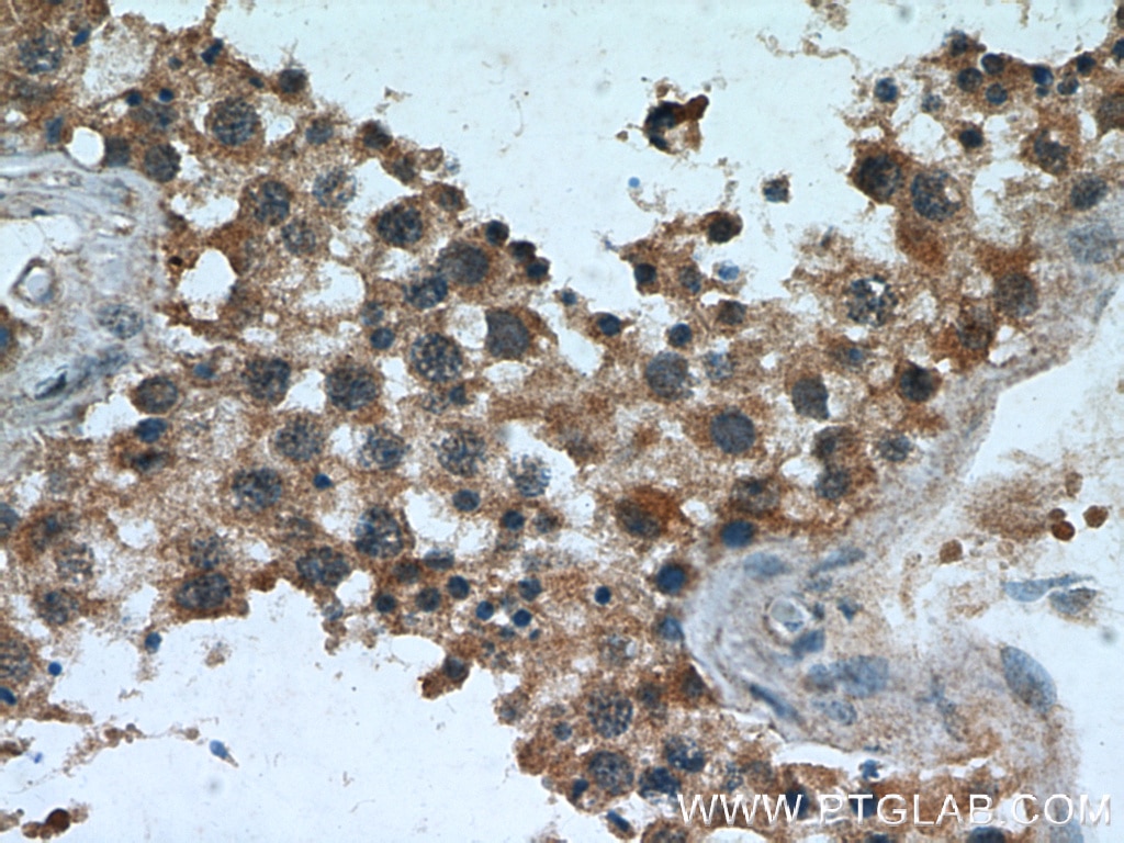 Immunohistochemistry (IHC) staining of human testis tissue using TPPII Monoclonal antibody (66017-1-Ig)