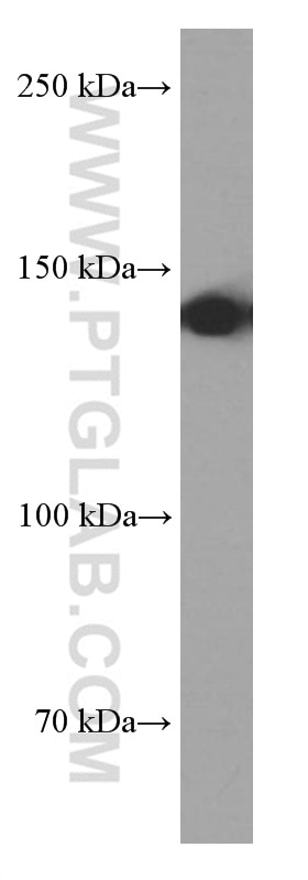 Western Blot (WB) analysis of Raji cells using TPPII Monoclonal antibody (66017-1-Ig)