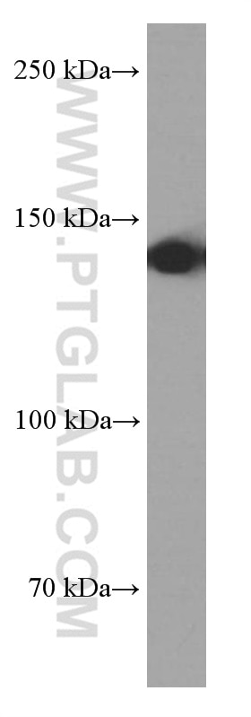 WB analysis of Raji using 66017-1-Ig