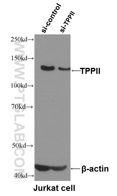 Western Blot (WB) analysis of Jurkat cells using TPPII Monoclonal antibody (66017-1-Ig)