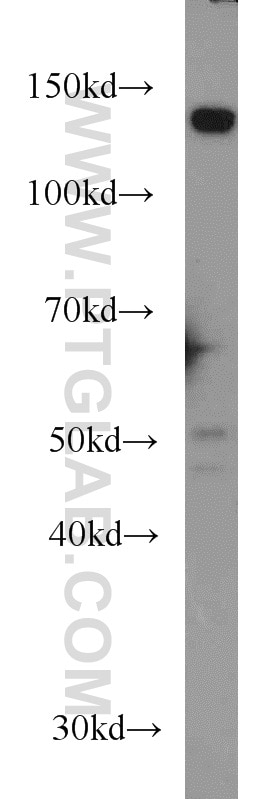 Western Blot (WB) analysis of HeLa cells using TPPII Monoclonal antibody (66017-1-Ig)