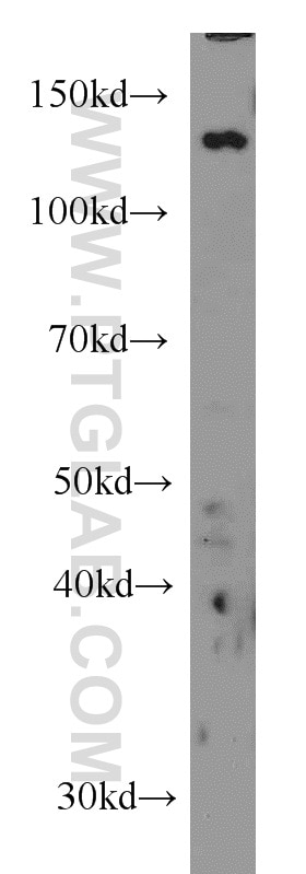 Western Blot (WB) analysis of HepG2 cells using TPPII Monoclonal antibody (66017-1-Ig)
