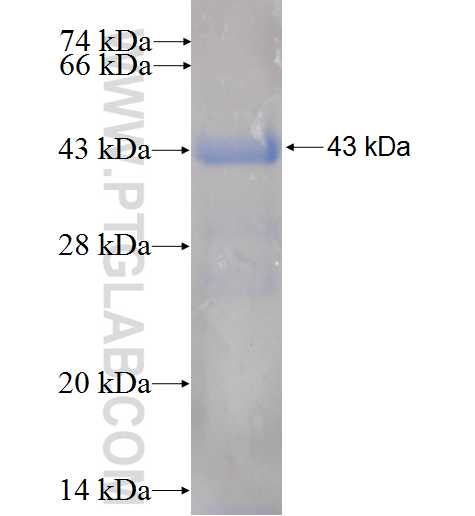 TPP2 fusion protein Ag5296 SDS-PAGE