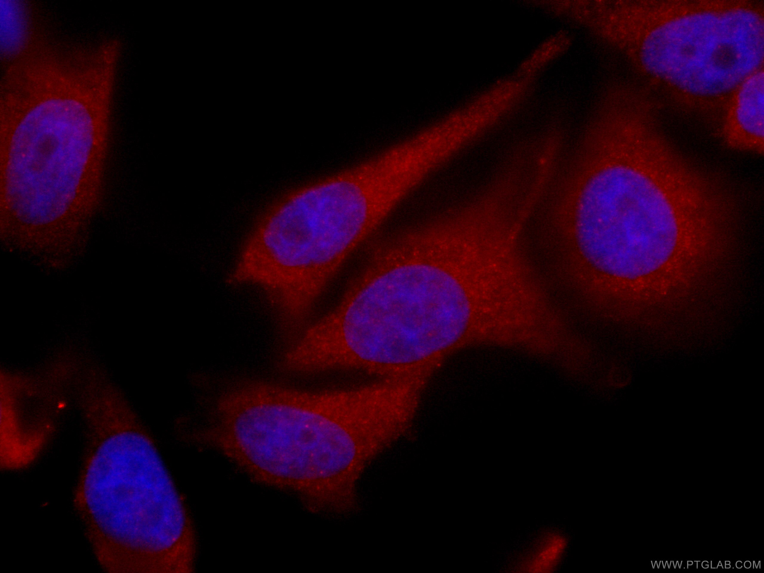 Immunofluorescence (IF) / fluorescent staining of HeLa cells using CoraLite®594-conjugated TPPII Monoclonal antibody (CL594-66017)