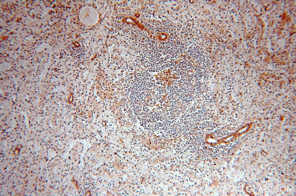 Immunohistochemistry (IHC) staining of human spleen tissue using TPPP Polyclonal antibody (18742-1-AP)