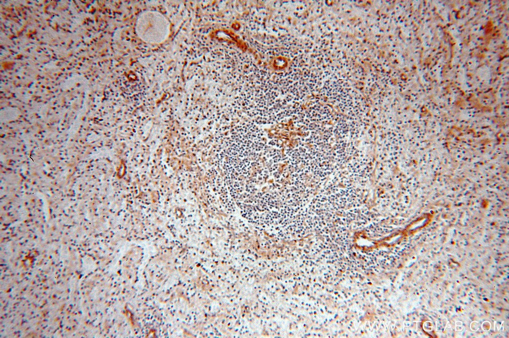 IHC staining of human spleen using 18742-1-AP