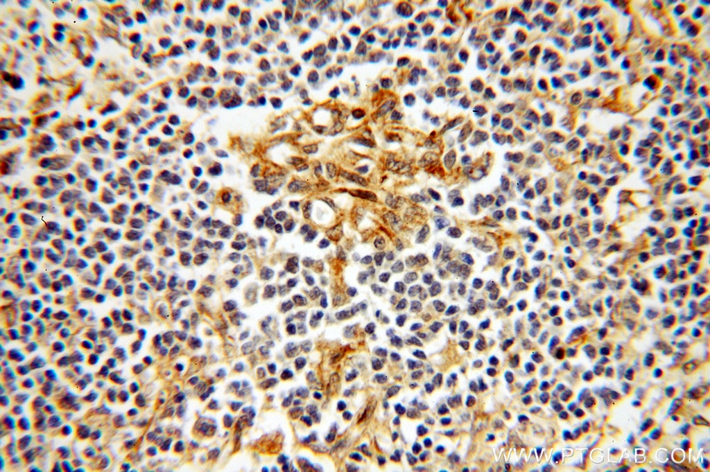 Immunohistochemistry (IHC) staining of human spleen tissue using TPPP Polyclonal antibody (18742-1-AP)