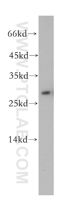 Western Blot (WB) analysis of mouse brain tissue using TPPP Polyclonal antibody (18742-1-AP)