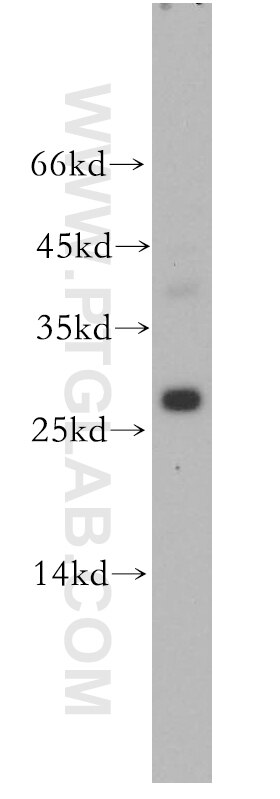 Western Blot (WB) analysis of mouse brain tissue using TPPP Polyclonal antibody (18742-1-AP)