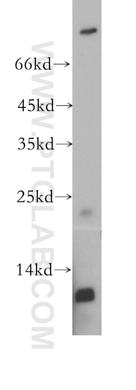 Western Blot (WB) analysis of MCF-7 cells using TPPP Polyclonal antibody (18742-1-AP)