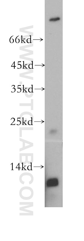 WB analysis of MCF-7 using 18742-1-AP