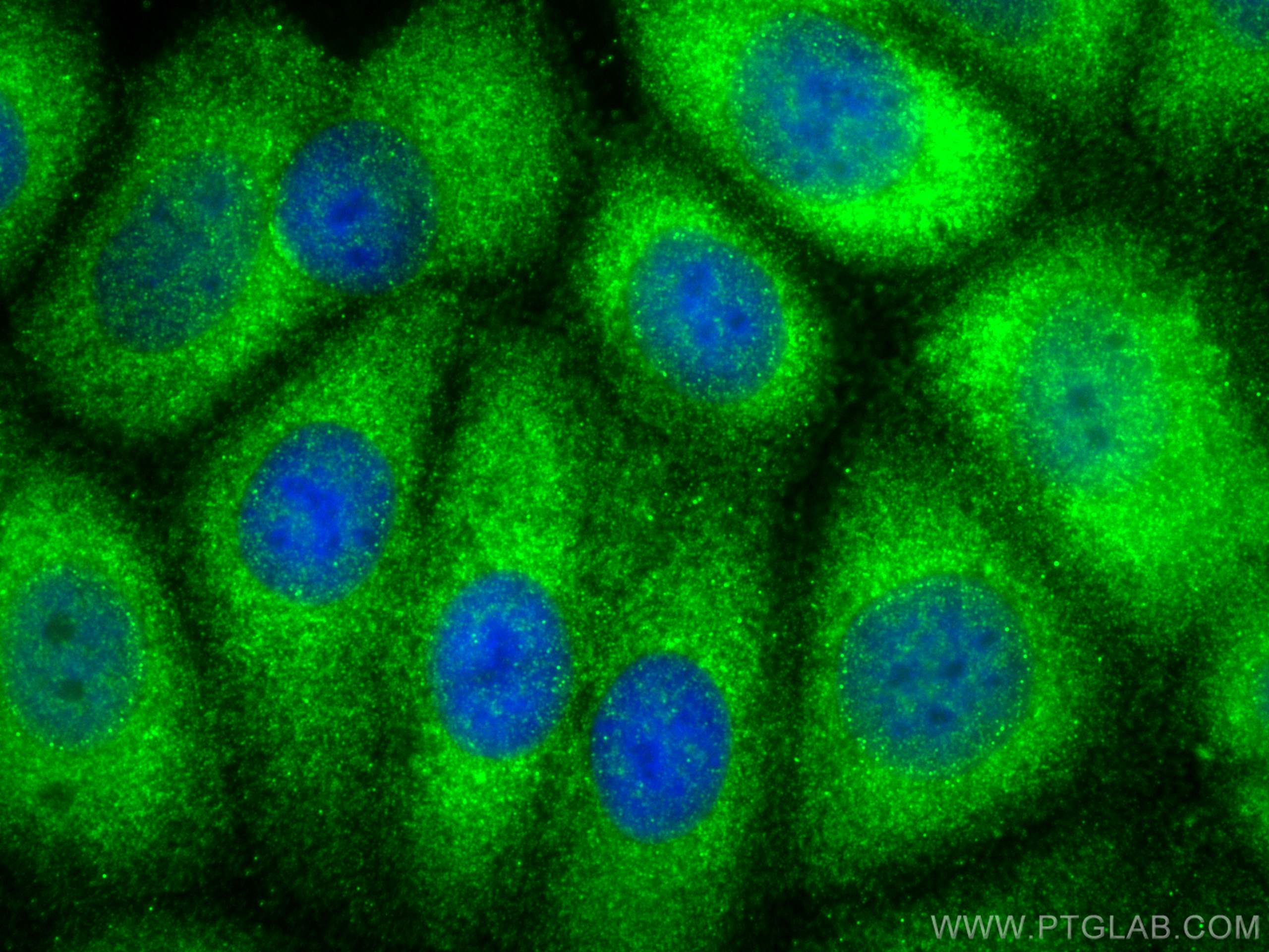Immunofluorescence (IF) / fluorescent staining of MCF-7 cells using TPPP Polyclonal antibody (25040-1-AP)