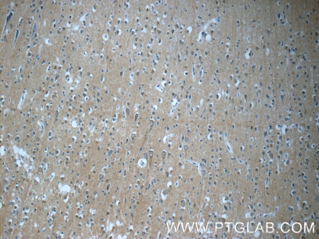 Immunohistochemistry (IHC) staining of human brain tissue using TPPP Polyclonal antibody (25040-1-AP)