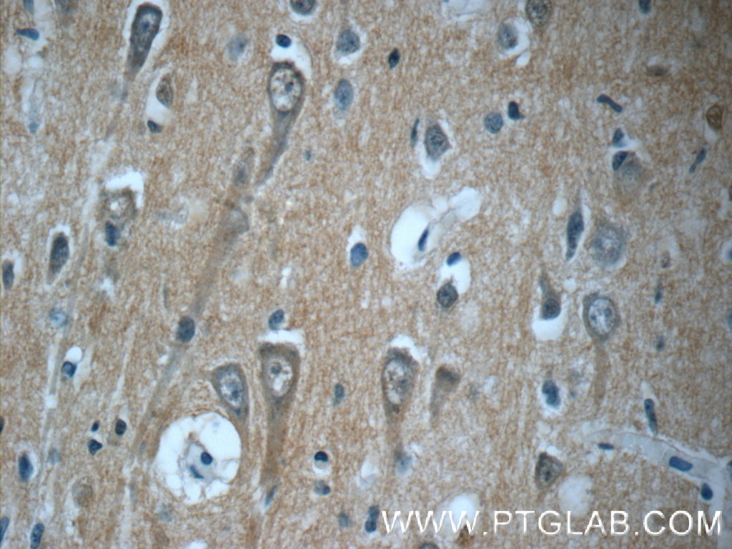 Immunohistochemistry (IHC) staining of human brain tissue using TPPP Polyclonal antibody (25040-1-AP)