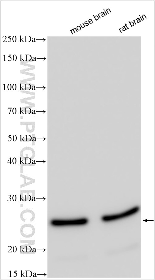 Western Blot (WB) analysis of various lysates using TPPP Polyclonal antibody (25040-1-AP)