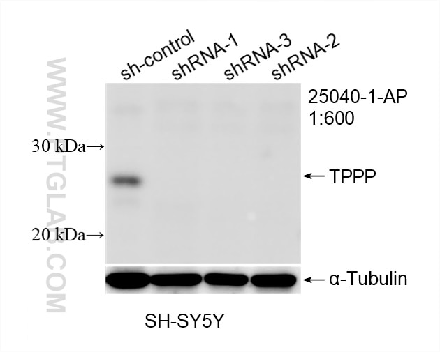 Western Blot (WB) analysis of SH-SY5Y cells using TPPP Polyclonal antibody (25040-1-AP)