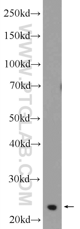 Western Blot (WB) analysis of MCF-7 cells using TPPP Polyclonal antibody (25040-1-AP)