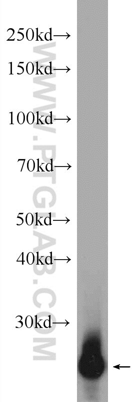 Western Blot (WB) analysis of mouse brain tissue using TPPP Polyclonal antibody (25040-1-AP)