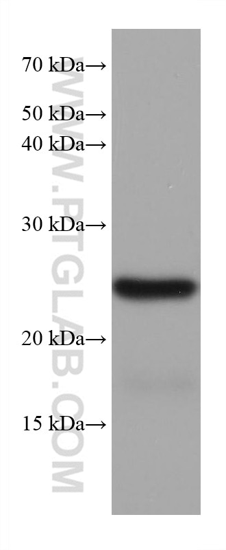 WB analysis of rat cerebellum using 68048-1-Ig