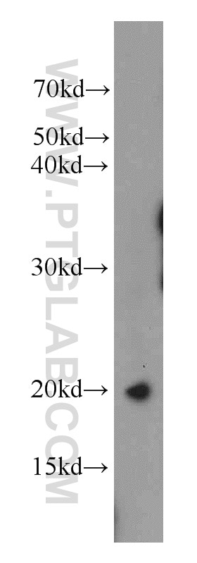 Western Blot (WB) analysis of PC-3 cells using TPPP3 Polyclonal antibody (15057-1-AP)