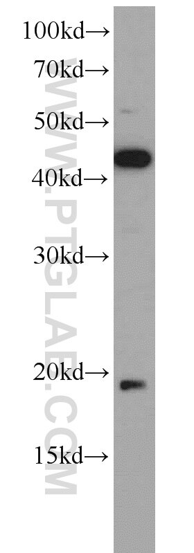 Western Blot (WB) analysis of HeLa cells using TPPP3 Polyclonal antibody (15057-1-AP)