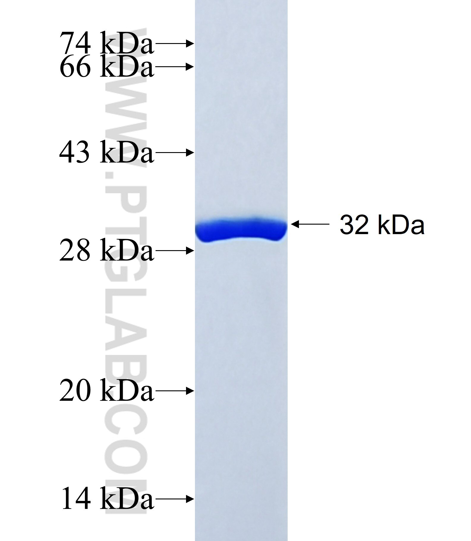 TPPP3 fusion protein Ag40389 SDS-PAGE TPPP3 fusion protein Ag40389 SDS-PAGE