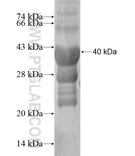 TPRG1 fusion protein Ag20106 SDS-PAGE TPRG1 fusion protein Ag20106 SDS-PAGE