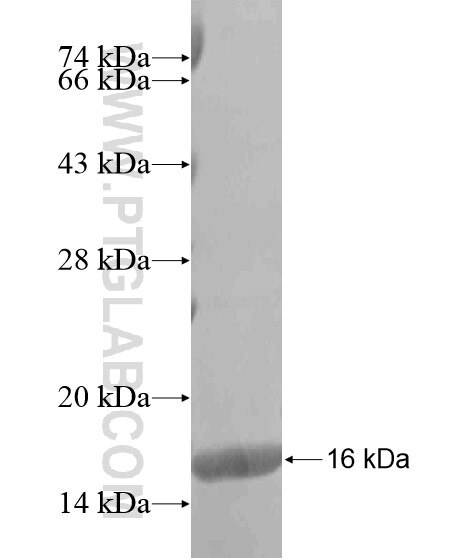 TPRG1 fusion protein Ag20255 SDS-PAGE TPRG1 fusion protein Ag20255 SDS-PAGE