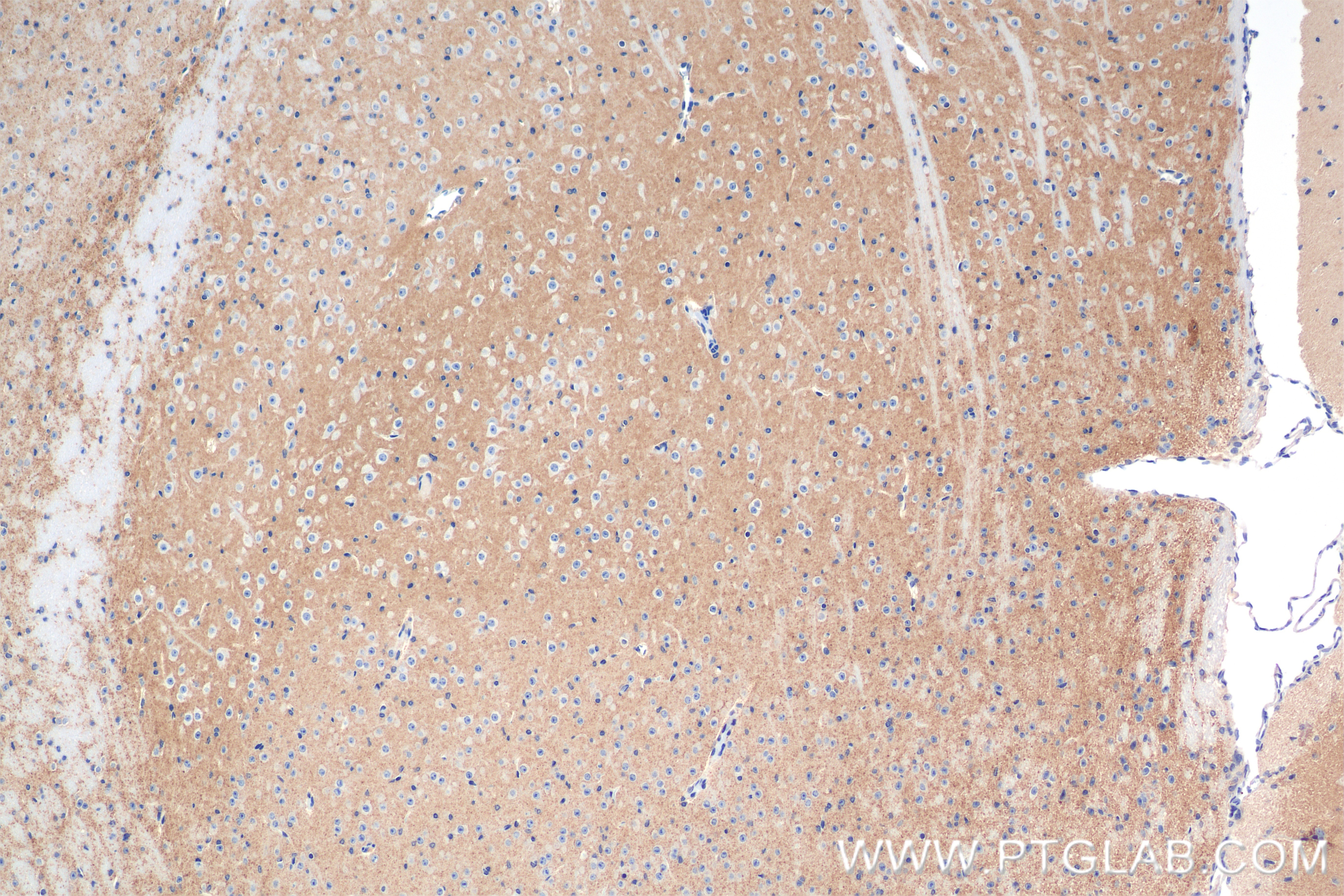Immunohistochemistry (IHC) staining of mouse brain tissue using TPRG1L Recombinant antibody (83989-3-RR)
