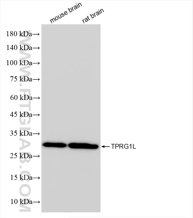 Western Blot (WB) analysis of various lysates using TPRG1L Recombinant antibody (83989-3-RR)