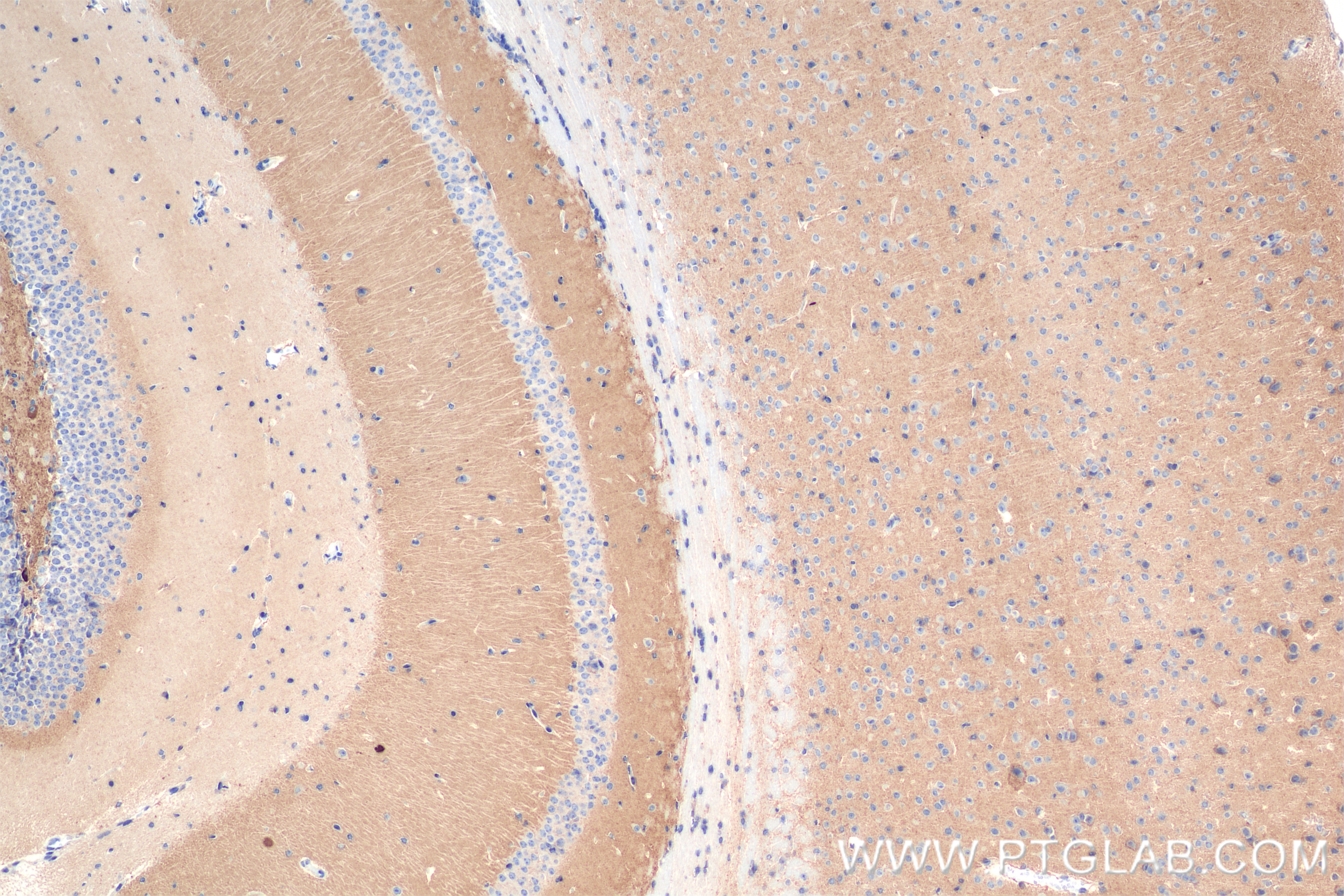 Immunohistochemistry (IHC) staining of mouse brain tissue using TPRG1L Recombinant antibody (83989-4-RR)