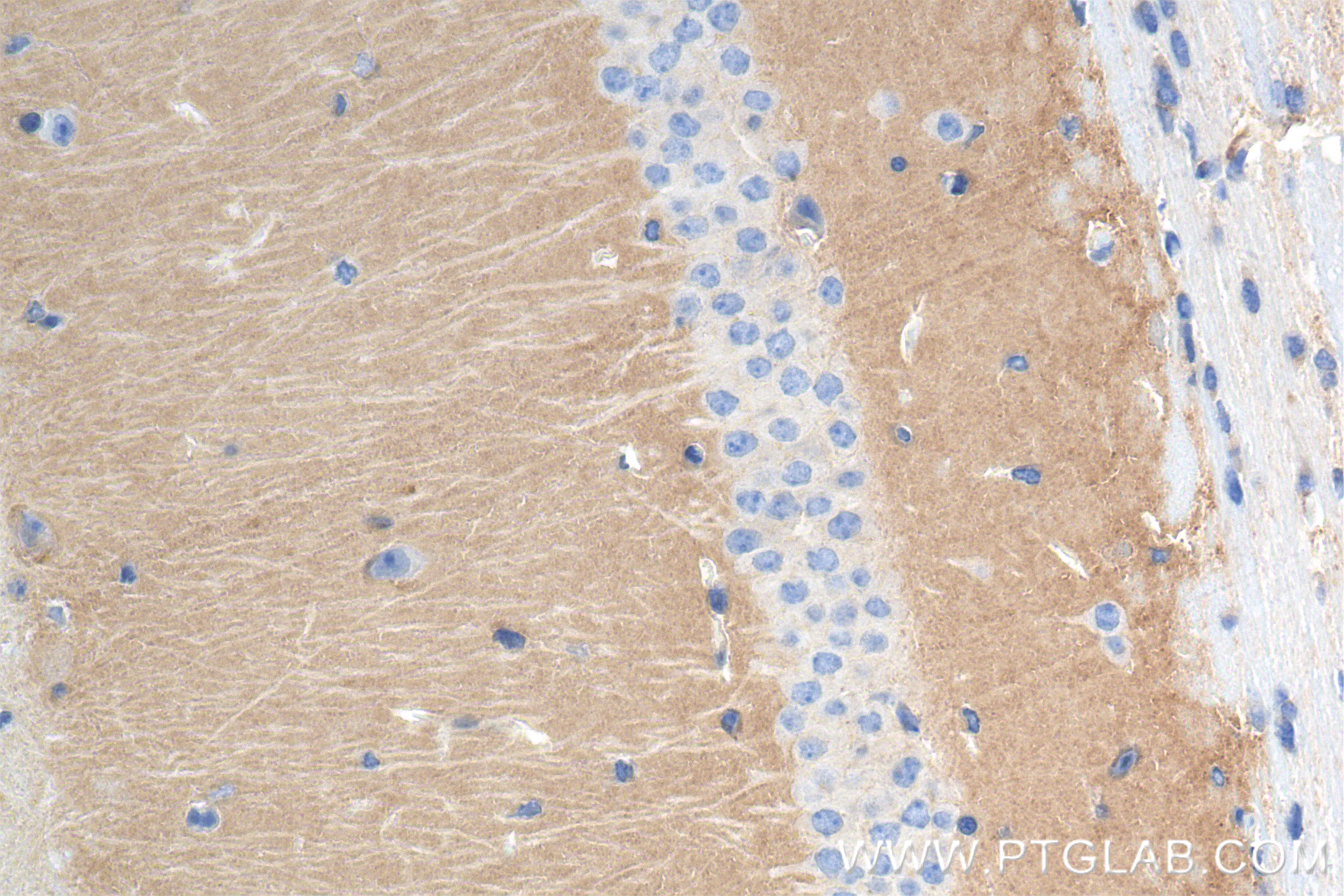 Immunohistochemistry (IHC) staining of mouse brain tissue using TPRG1L Recombinant antibody (83989-4-RR)