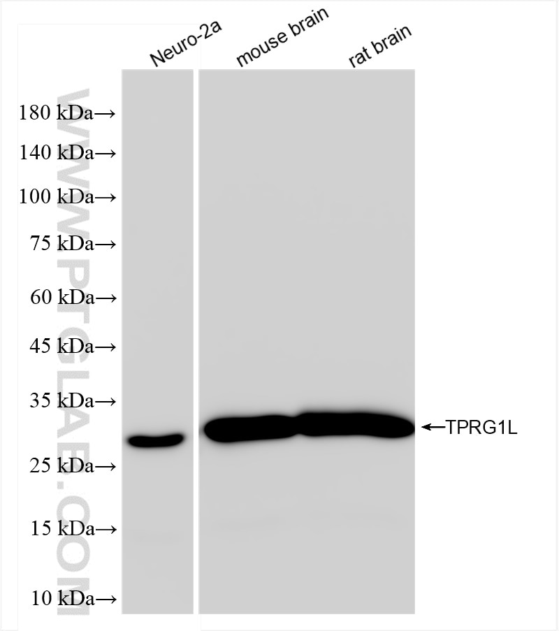 Western Blot (WB) analysis of various lysates using TPRG1L Recombinant antibody (83989-4-RR)
