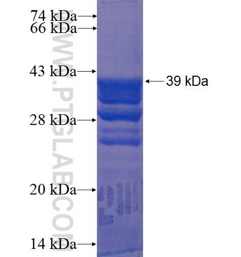 TPRG1L fusion protein Ag22585 SDS-PAGE