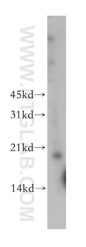 Western Blot (WB) analysis of human heart tissue using TPRKB Polyclonal antibody (12800-1-AP)