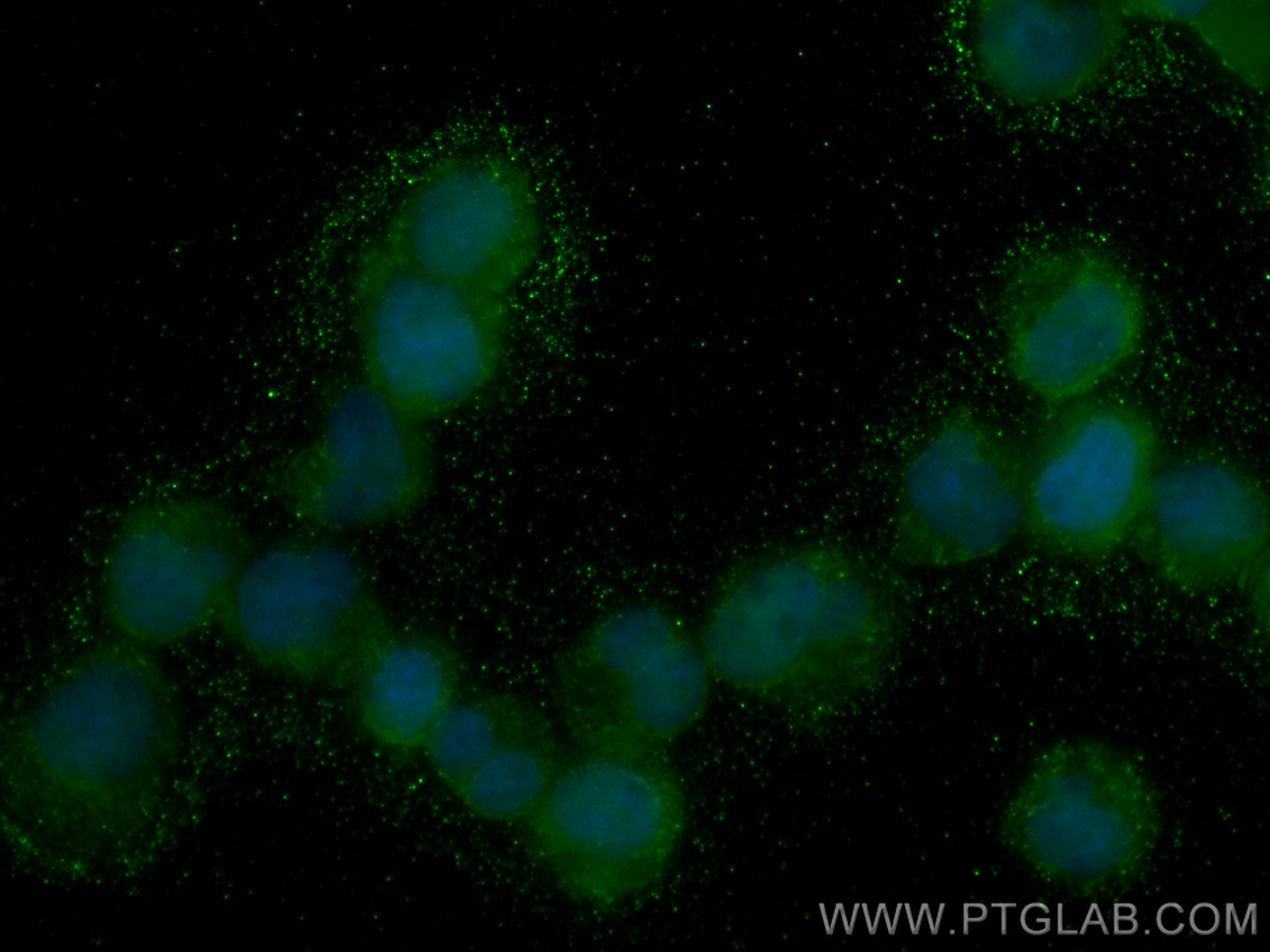 Immunofluorescence (IF) / fluorescent staining of Jurkat cells using TPRKB Monoclonal antibody (66402-1-Ig)