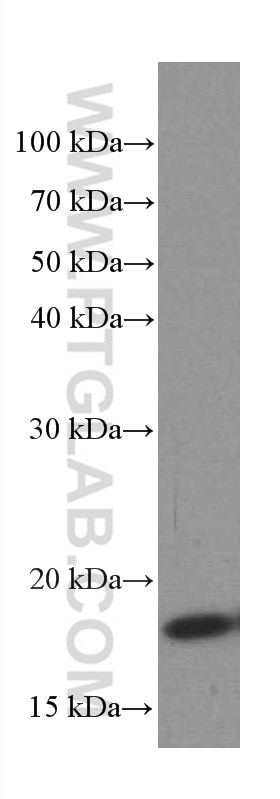 Western Blot (WB) analysis of HeLa cells using TPRKB Monoclonal antibody (66402-1-Ig)