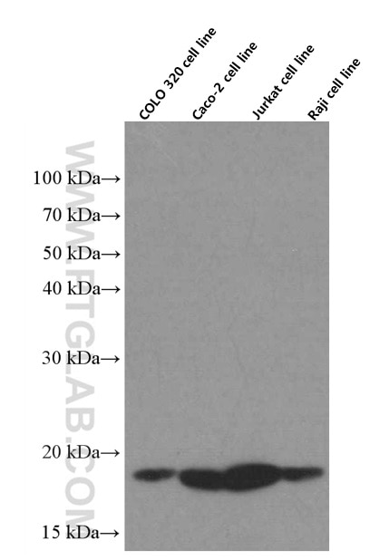 Western Blot (WB) analysis of various lysates using TPRKB Monoclonal antibody (66402-1-Ig)