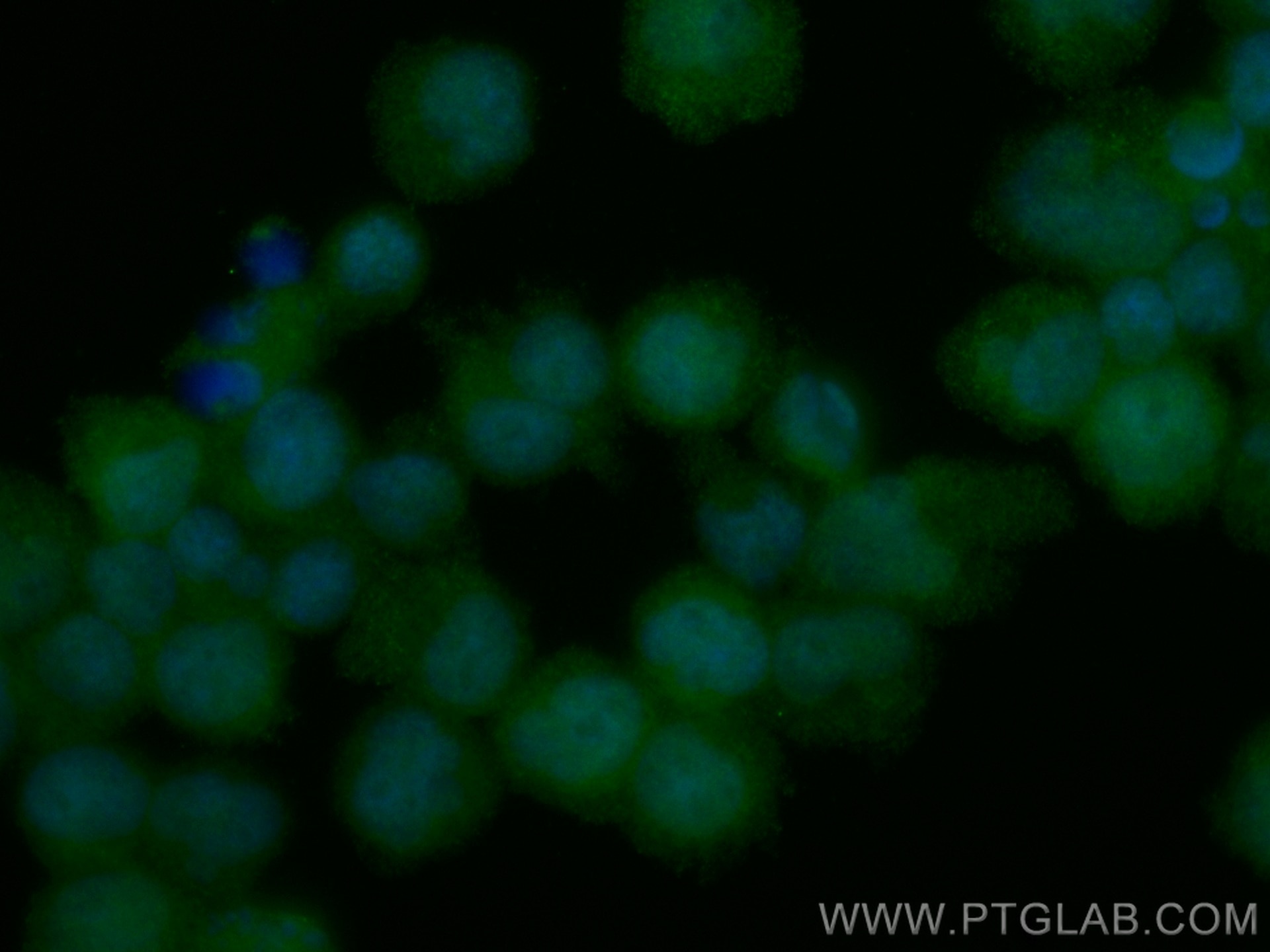 Immunofluorescence (IF) / fluorescent staining of Jurkat cells using CoraLite® Plus 488-conjugated TPRKB Monoclonal ant (CL488-66402)