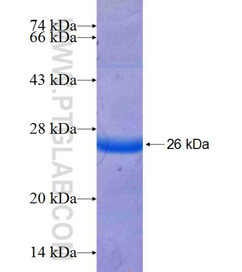 TPRKB fusion protein Ag18770 SDS-PAGE